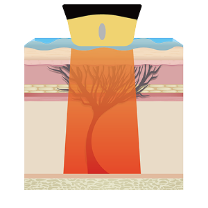 보이는 초음파 확인