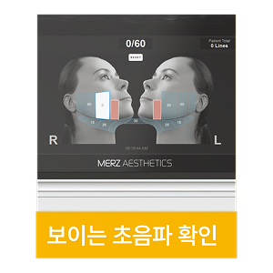 보이는 초음파 확인