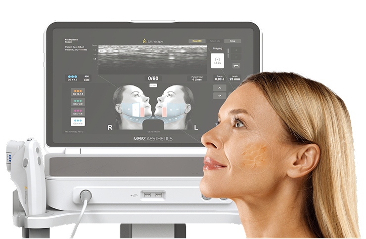 Ultherapy Prime Treatment